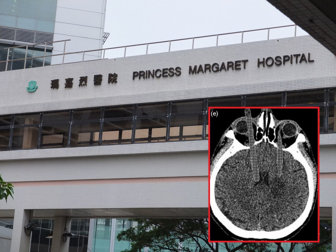 玛嘉烈医院。资料图片