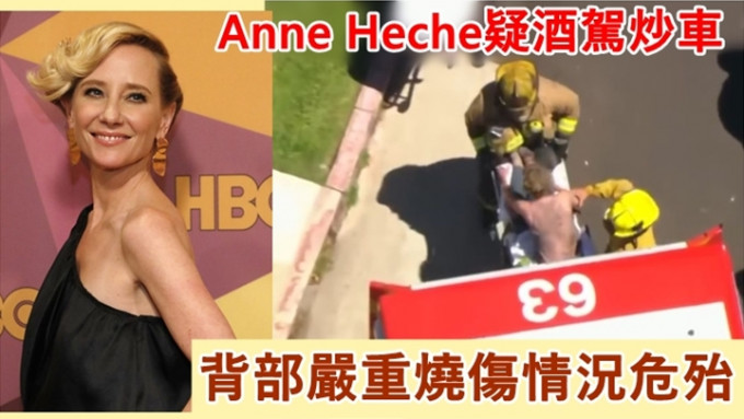 荷里活女星Anne Heche在洛杉矶发生严重车祸，目前情况危殆。