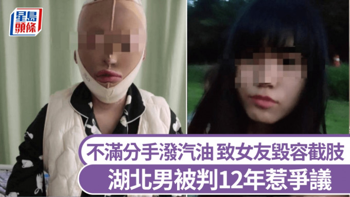 湖北一男子因不滿分手潑汽油，致女友全身7成燒傷毀容截肢，被判12年有期徒刑。