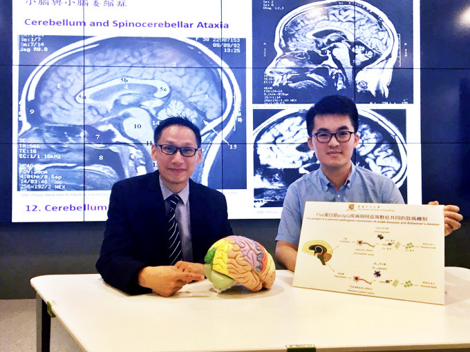 中文教授陈浩然及研究团队最近发现形成小脑萎缩症三型的致病原因，有助研发药物治愈。