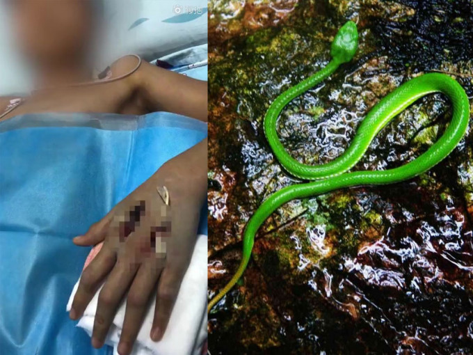 13岁男生网购竹叶青蛇当宠物被咬险送命。