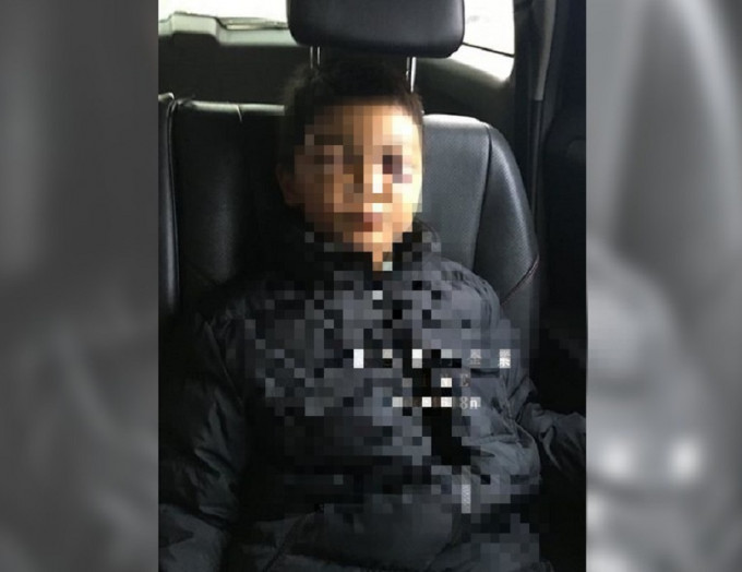 一位家住苗栗的男童遭继父、生母殴打伤势严重。网上图片