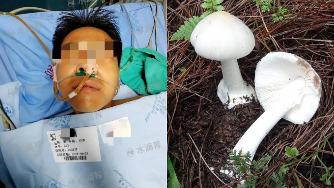 一家4口误食野生「鹅膏菇」中毒，1人已死，家属网上众筹。