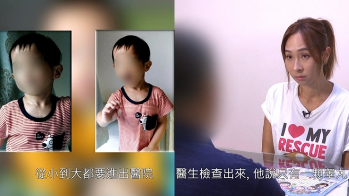 东张西望丨7岁半细孖患隐睾症错过治疗期   家长忧影响生育质疑医院疏忽