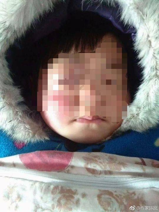 河南夫妇将患有眼癌的3岁女儿的照片发布到网络上。（网图）
