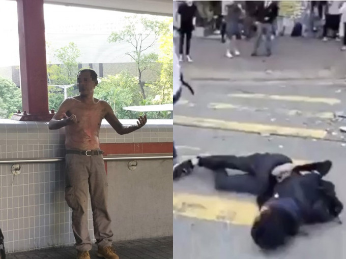 遭燒傷男子（左）及中槍男學生（右）。（資料圖片）