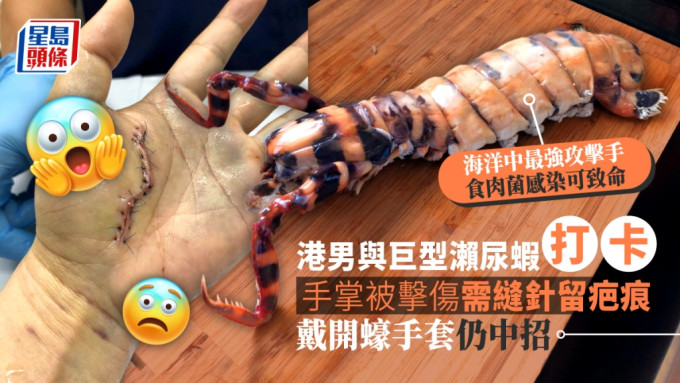 港男打算拿著瀨尿蝦拍照「打卡」時，意外被瀨尿蝦擊傷，需入院縫針。「香港街市魚類海鮮研究社」FB