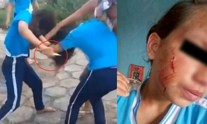 巴西两名女初中生在学校门外互殴，其中13岁女生被刺伤，情况极为严重。