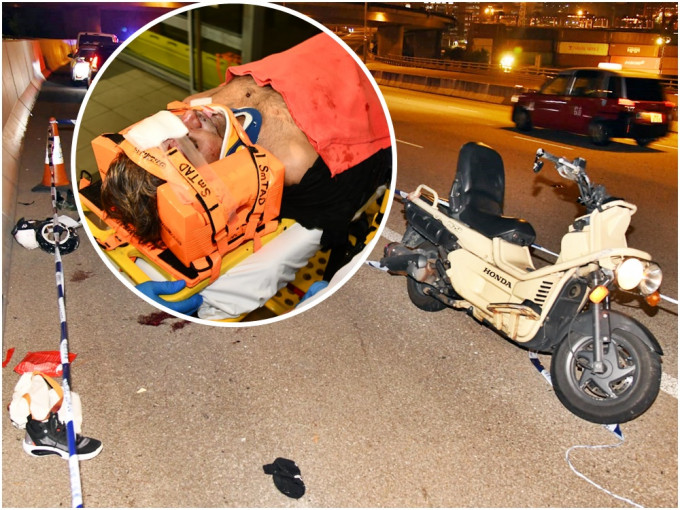 45岁南亚裔司机（小图）头部重创，昏迷送院抢救。