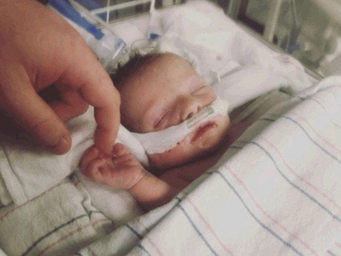 Emmitt出生仅11日便不敌病毒攻击离世。dakotaelizabethgoss Instagram图片