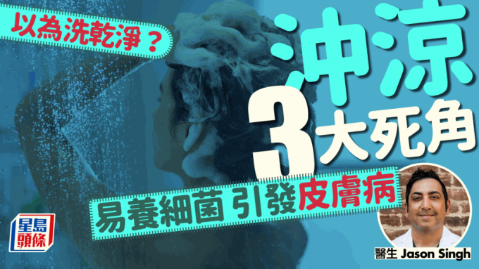 醫生揭沖涼3大死角！洗不乾淨易養細菌真菌 引發皮膚病