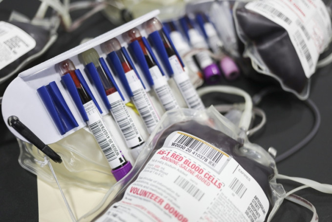 意大利北部小鎮有60名捐血者中有40人確診 ，均為無症狀患者。（示意圖，AP）