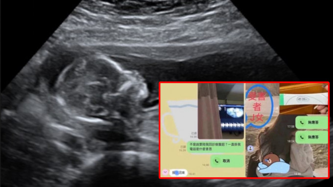台湾传有男护士与10名女护有染，更令4人怀孕。