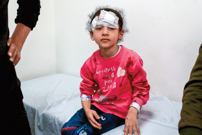 巴勒斯坦一名女童，在以軍轟炸加沙南部拉法市時受傷。