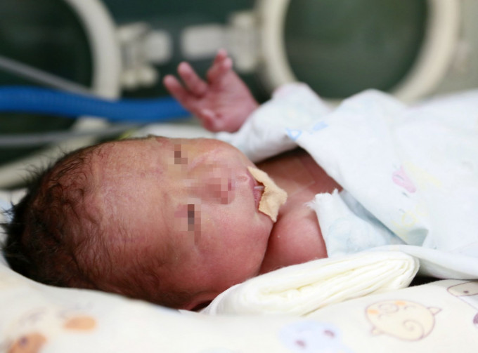 中国首个移植子宫内孕育的婴儿，于上周日出生。新华社图片