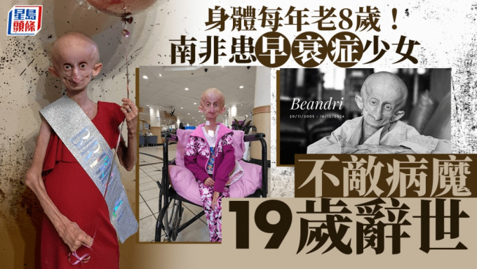 南非少女班德莉（Beandri Booysen）患有罕见疾病「早衰症」。