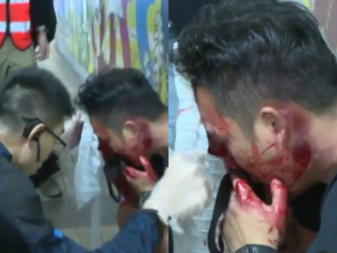 疑有臥底警員被圍毆至頭破血流。now新聞截圖