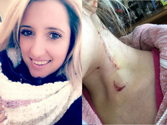 英国一名25岁的女推销员在街头被陌生男子持刀刺11次，一条廉价围巾救了她一命。（网图）