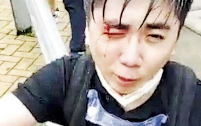 楊子俊在612事件中右眼受傷。網圖