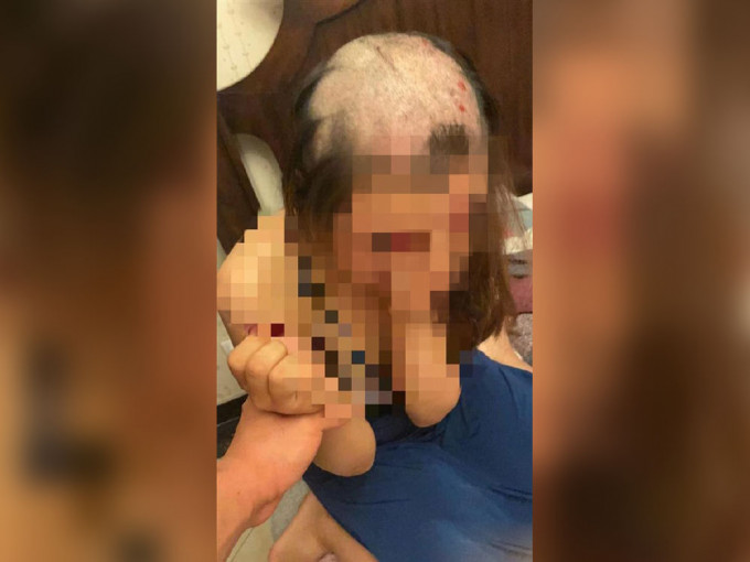 河北女子遭丈夫剃头被逼承认出轨，警方介入调查。