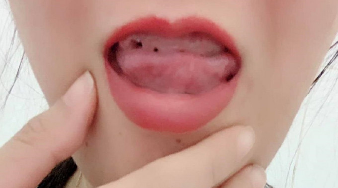 台湾一名女子狠心找无牌医生拔光整口牙。网上图片