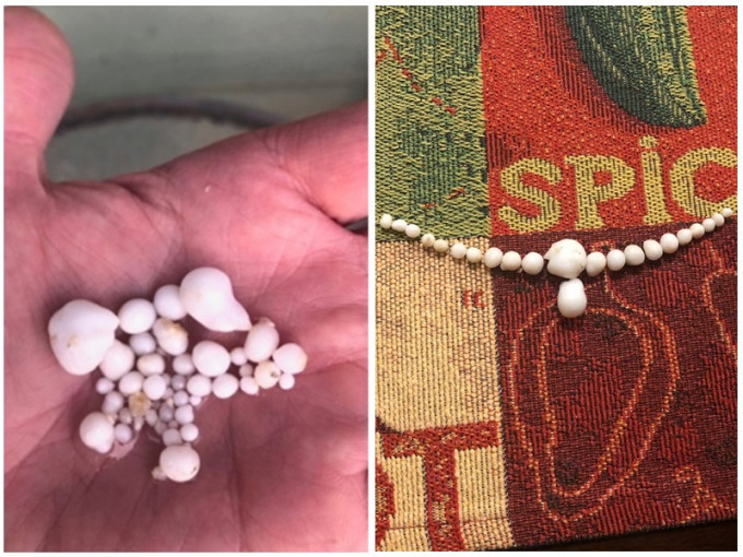加汉吃生蚝 竟吐出48粒珍珠。 网图