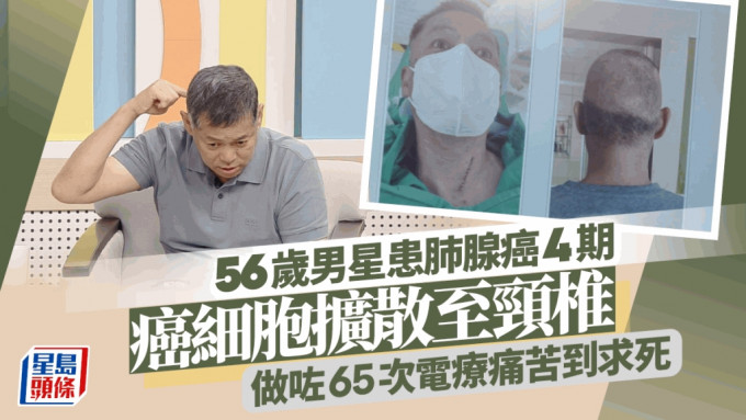 56歲男星患肺腺癌4期擴散到頸椎做65次電療 做化療好痛苦向上天喊話：拜託把我帶走