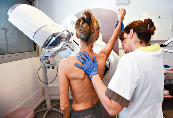 一名女子接受乳房X光造影檢驗。