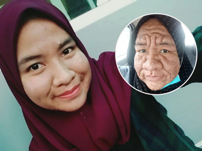 马来西亚一名孕妇因激素骤变满脸皱纹，惊变「老太婆」。FB图