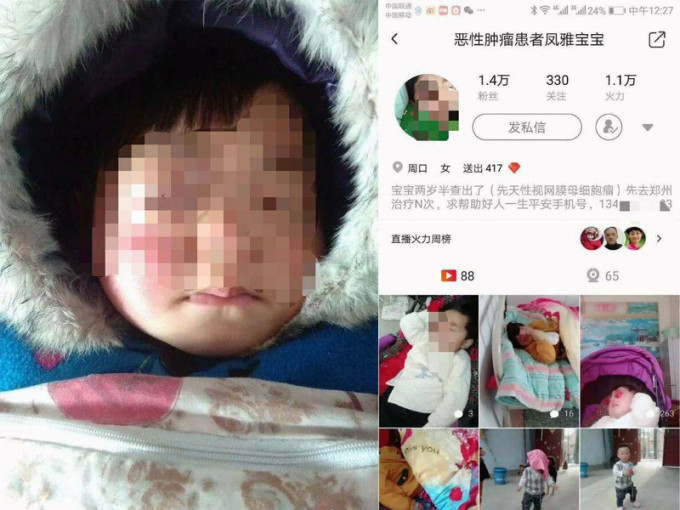 河南一对夫妇怀疑利用患有眼癌的3岁女儿，在社交网络发起筹款。（网图）