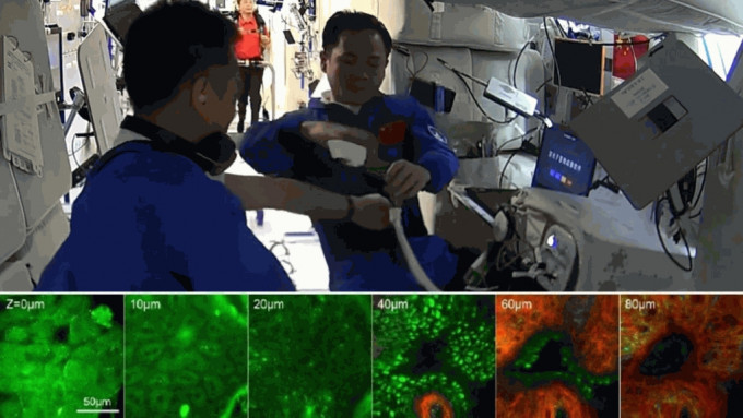神十五双光子显微镜在轨实验成功，首获太空人皮肤三维图像。