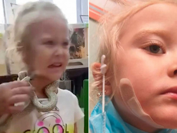 俄5岁女童颈挂蛇拍照，疑因身上飘「鸡肉味」被撕咬。