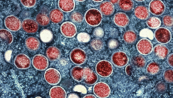 北京首次发现猴痘病例。AP资料图