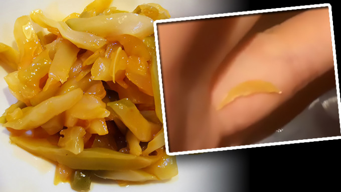 上海有市民投訴在所購買的烏江榨菜裡吃出腳指甲(小圖)。有關商家表示已介入調查。(背景榨菜為示意圖，非涉事產品)