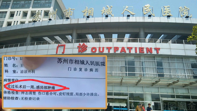 江苏苏州市相城人民医院摆大乌龙，女病人竟被诊断「包皮过长」。
