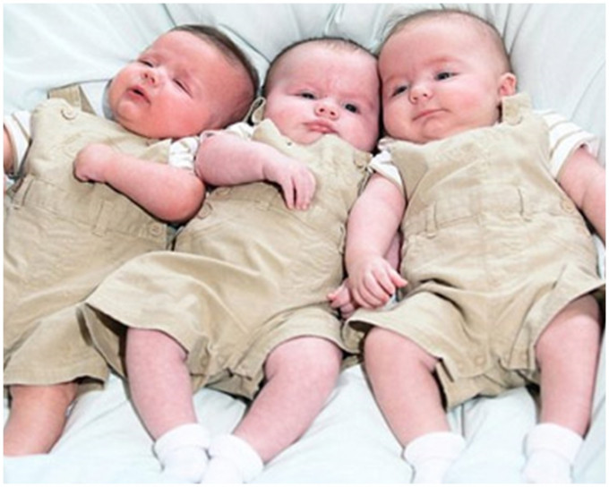 三胞胎不同時間懷孕這種罕見的生理現象這稱為「複孕」 (superfoetation)。網上圖片