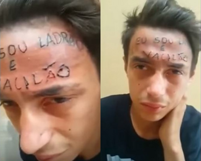 17歲青年遭行私刑額頭紋「我是小偷」。網上圖片