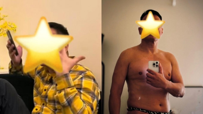 57歲前TVB男星獨自入院手術晒插針照：又一個不會埋口的傷疤 自爆腎衰竭需終身洗腎