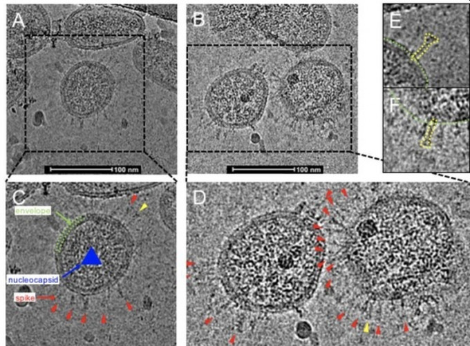 深圳利用顯微鏡觀察到新冠病毒的真實樣貌。(網圖)