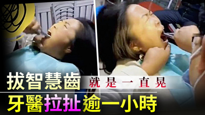 河北唐山市一名婦人拔智慧齒時，被牙醫持鉗拉扯逾一小時，引發熱議。網上影片截圖
