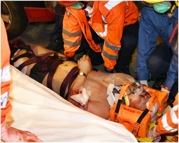 事主受伤，清醒被送往伊利沙伯医院抢救。