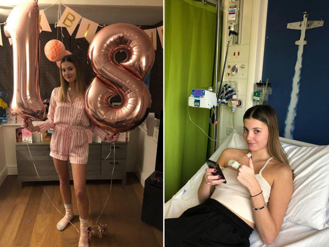 英國一名18歲少女確診腸癌後4個月內離世，成該國因腸癌死亡最年輕者之一。（網圖）