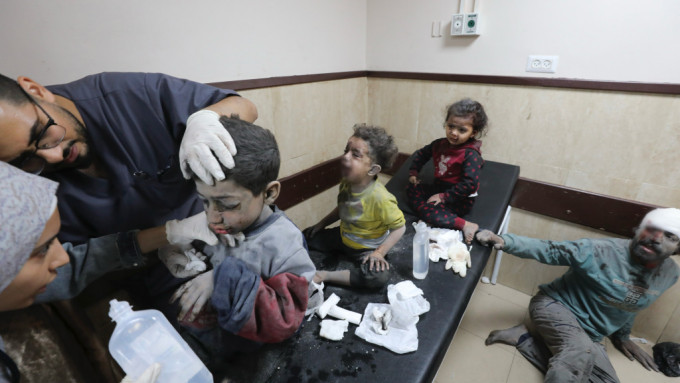 受傷的加沙兒童在醫院接受治理。 美聯社