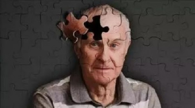老年痴呆症是老人杀手之一，至今没有特效药。