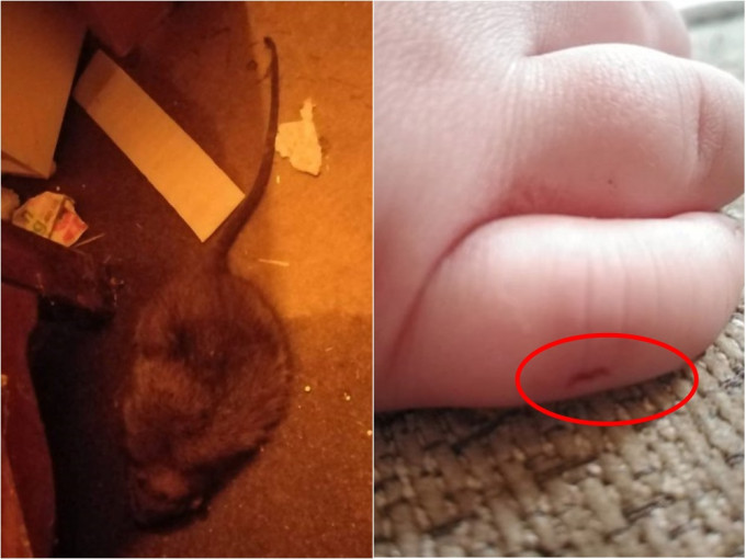英国一名岁半男婴遭老鼠咬伤。网图