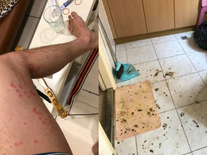 清潔工被叮咬。「爆怨公社」圖片