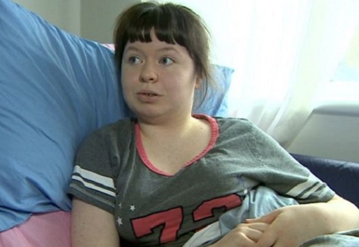 患有遺傳疾病的17歲英國少女加德（Jade Gadd）。 網上圖片