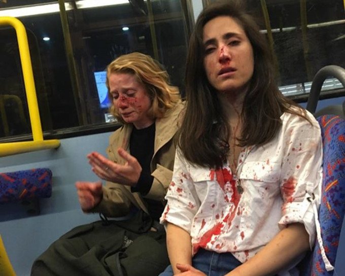 兩名女同性戀者被襲後血流披面。fb