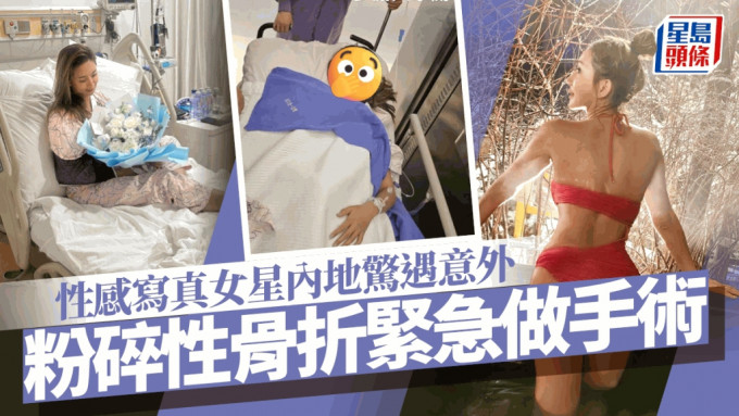 性感寫真女星內地驚遇意外！一原因致粉碎性骨折  緊急做手術坐專機返港