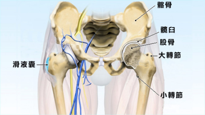 髖關節連接人體的上身和下肢，是身體最大的球窩關節。